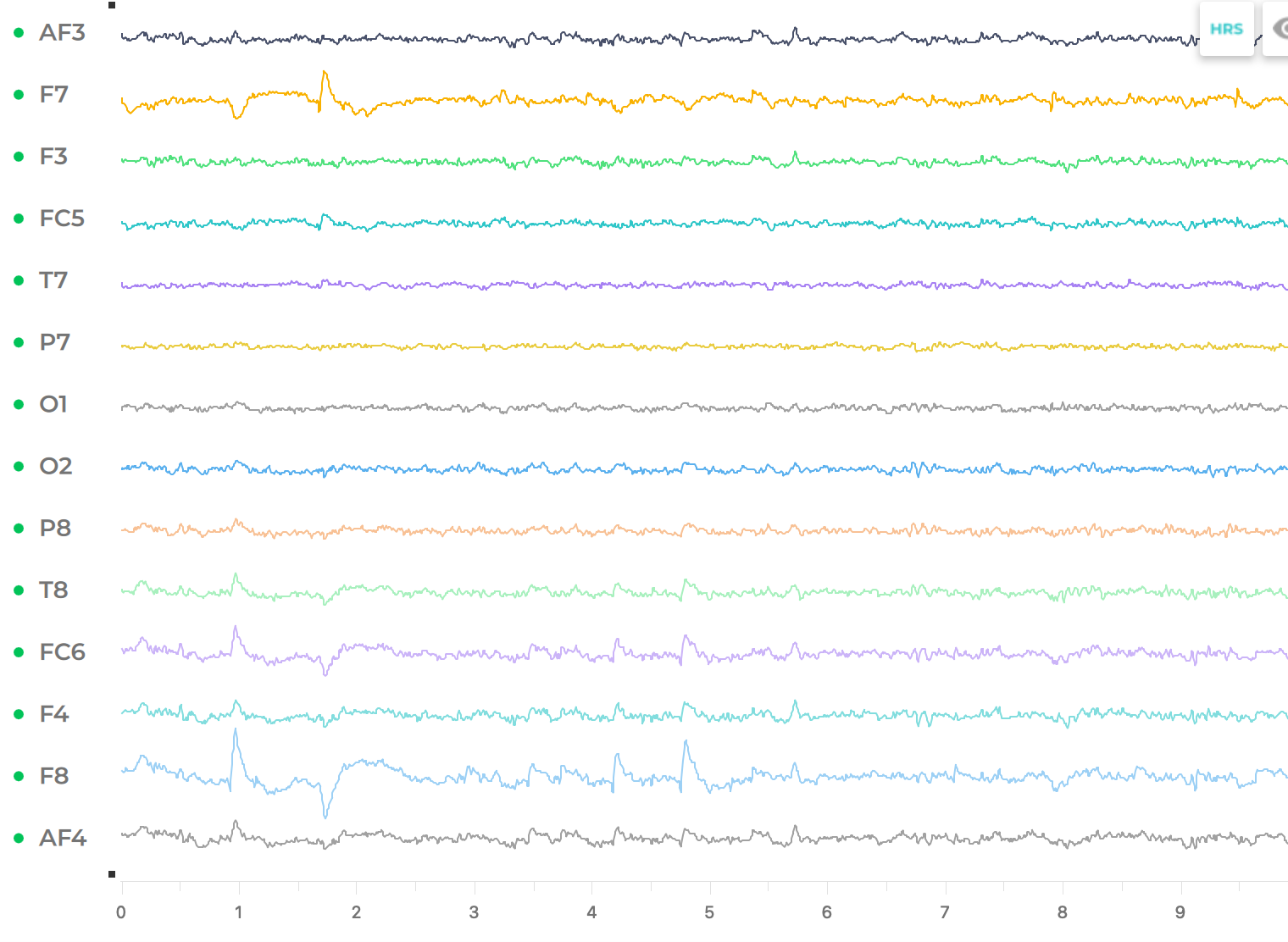 Read more about the article EEG Analysis